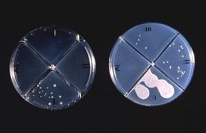 
Agar culture plates used to test efficacy of new drugs against TB.
