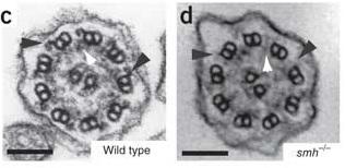 
Electron micrographs of cilia axonemes in a wild-type (c) and smh (d) pronephric duct.
