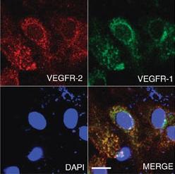 
Microscopy showing a representative image of VEGFR-1 co-localized with VEGFR-2
